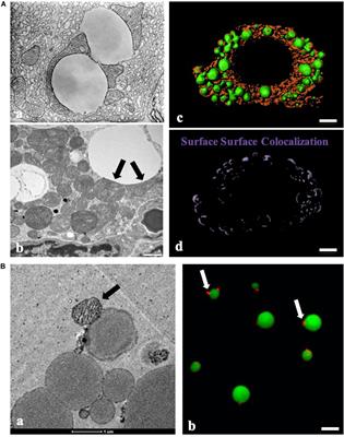 Two Types of Contact Between Lipid Droplets and Mitochondria